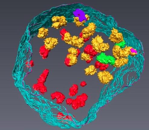 Revealing the Structure of Human Chromosomes and Nucleus in Three Dimensions