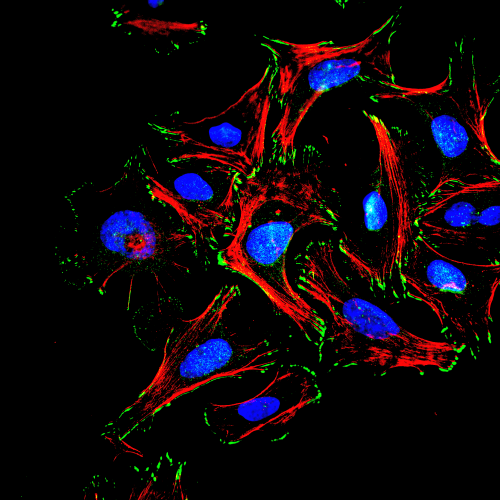 Researchers awarded £3.5m to study how certain cells use and resist force