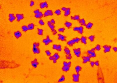 Image-of-chromosomes