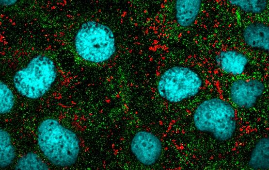 Gold beads may boost cancer treatment