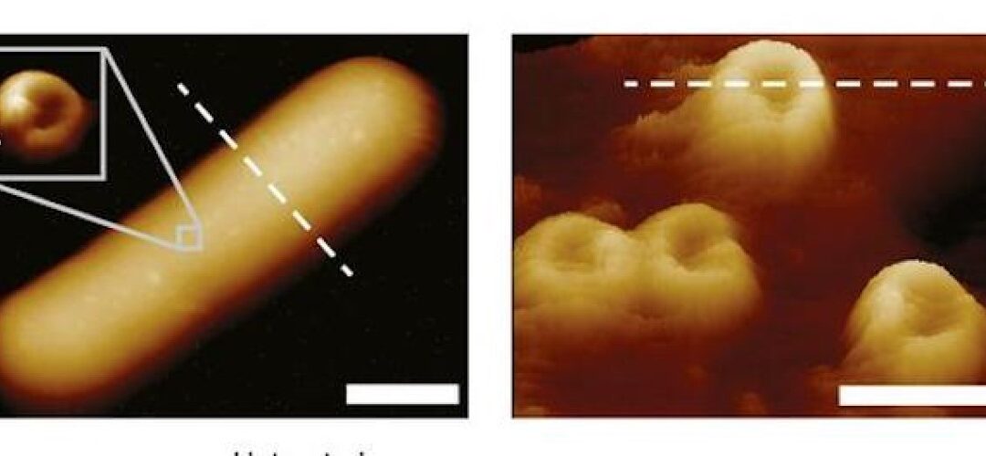 Filming how our immune system kills bacteria