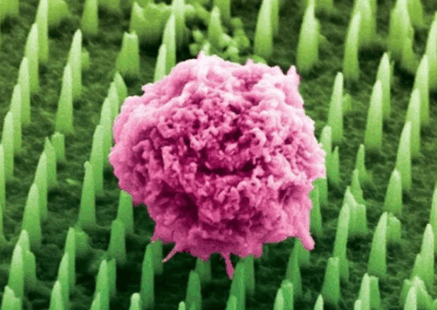 Tens of millions of nanoneedles could replace painful cancer biopsies
