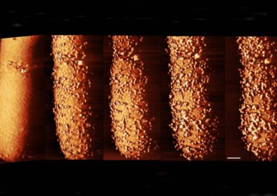 Startling images show how antibiotic pierces bacteria’s armour