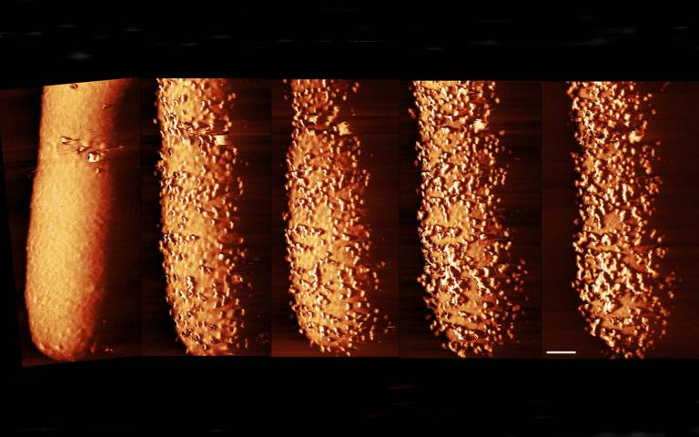 Startling images show how antibiotic pierces bacteria’s armour